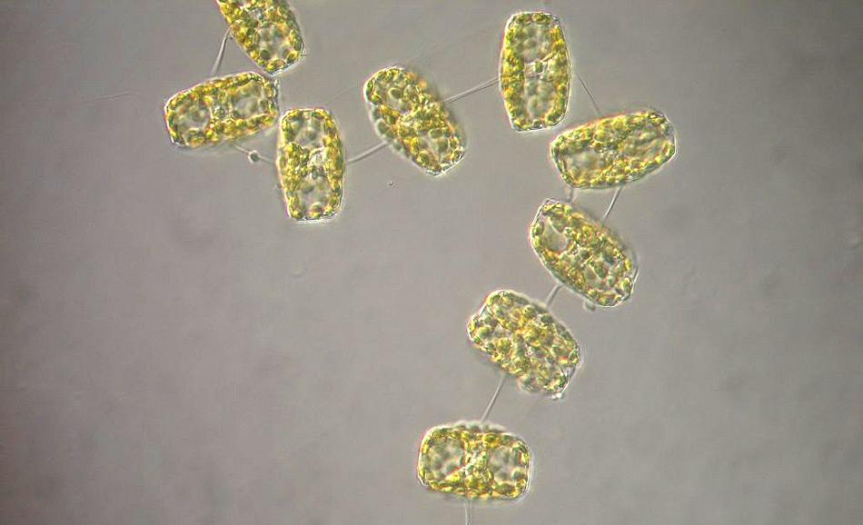 Eine Phytoplanktonkette aus der Gattung Thalassiosira. (Photo: Andrew Davidson)